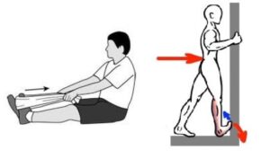 علاج القدم المسطحة