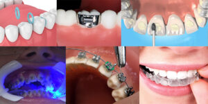 Orthodontic